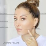 Read more about the article Dermal Fillers