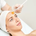 Read more about the article Glycolic Peel