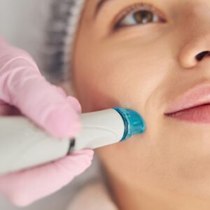 Hydrodermabrasion Facial