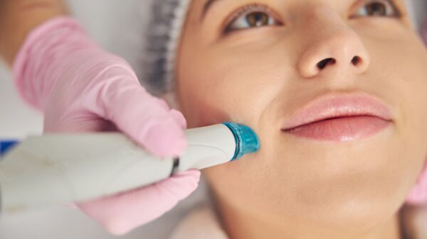 Hydrodermabrasion Facial