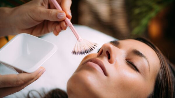 20% Off on All Levels Chemical Peels