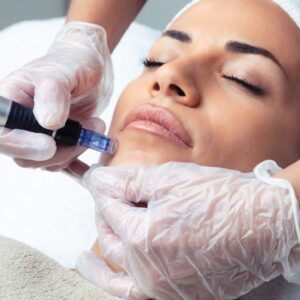Microdermabrasion with Pumpkin Peel