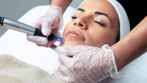 Microdermabrasion with Pumpkin Peel